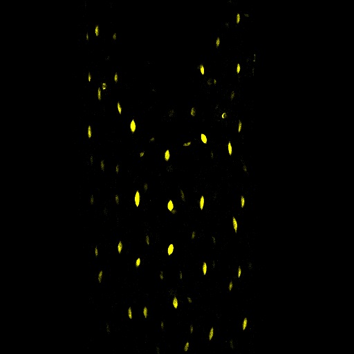 Confocal analysis of DGAT2 promoter activity