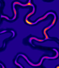 FRET imaging