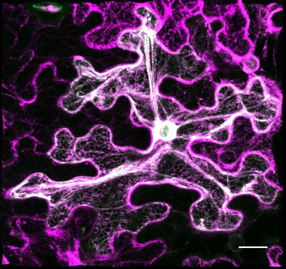 Protein localization imaging