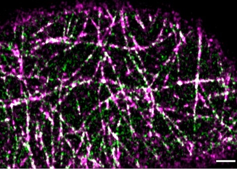 Colocalization imaging and analysis