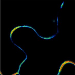 Imaging of membrane lipid order