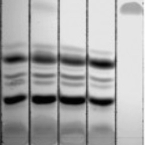 Lipid biochemistry